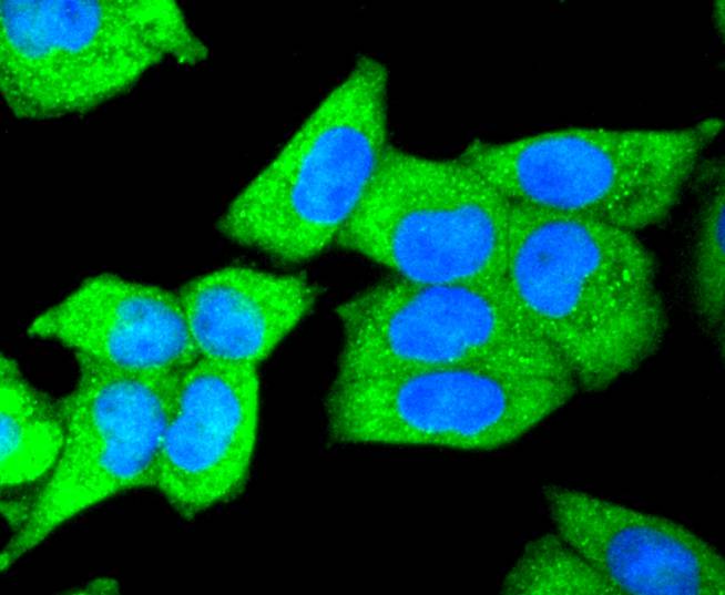 DKK1 Rabbit mAb