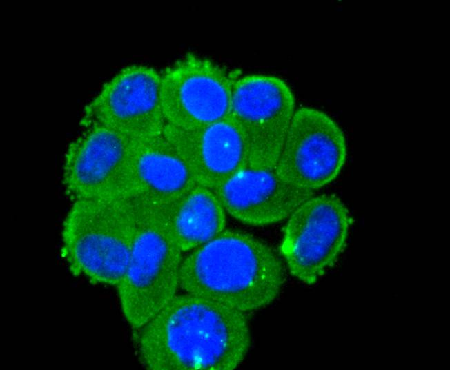 DKK1 Rabbit mAb