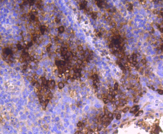 Mast Cell Tryptase Rabbit mAb