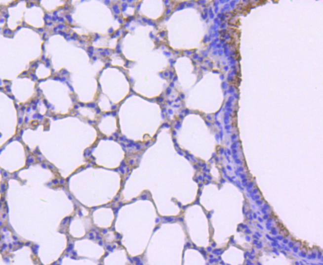 Mast Cell Tryptase Rabbit mAb