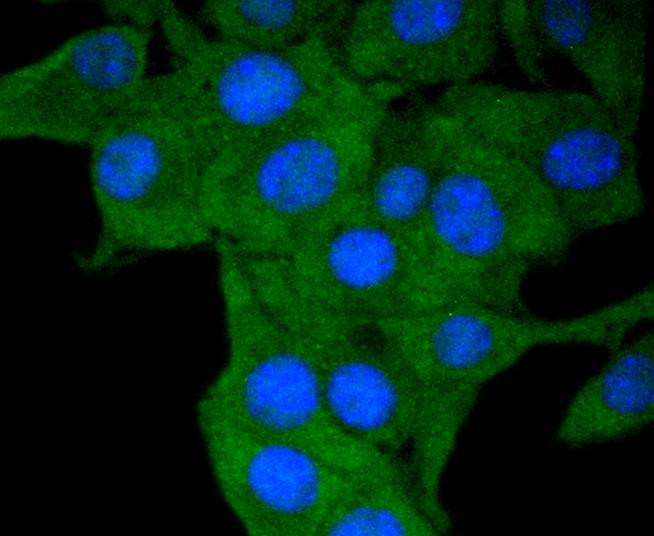 HLA-DR Rabbit mAb