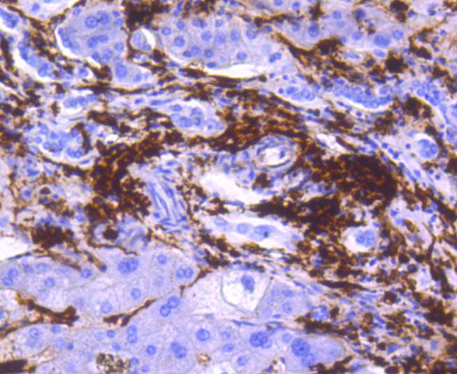 HLA-DR Rabbit mAb