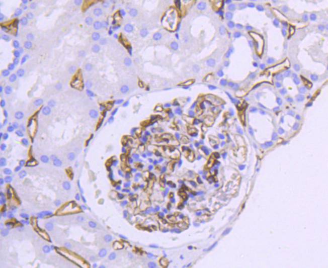 HLA-DR Rabbit mAb