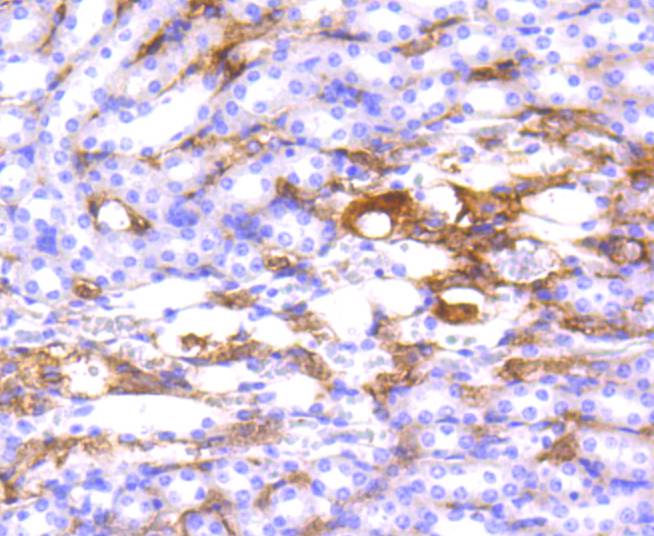 HLA-DR Rabbit mAb