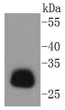 HLA-DR Rabbit mAb