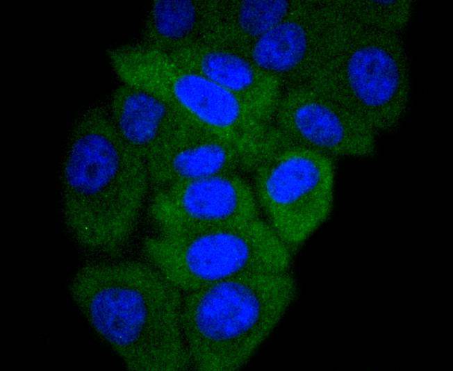 GART Rabbit mAb