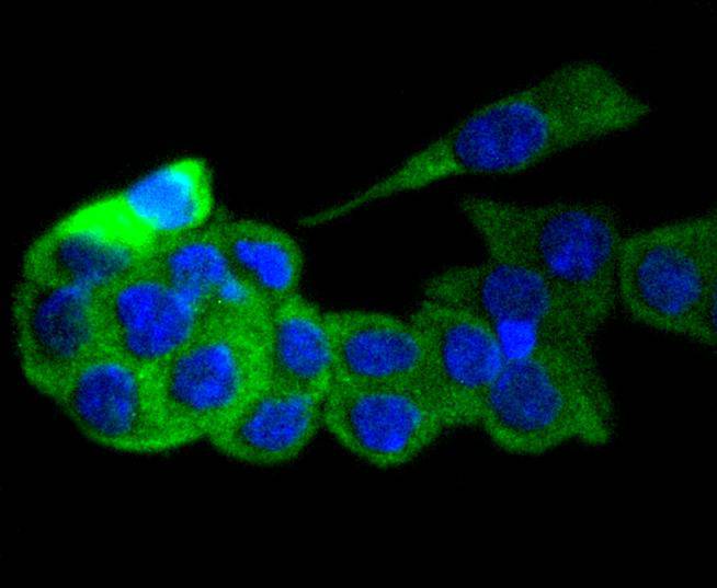 GART Rabbit mAb