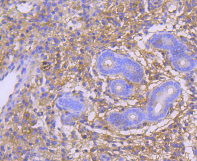 GART Rabbit mAb