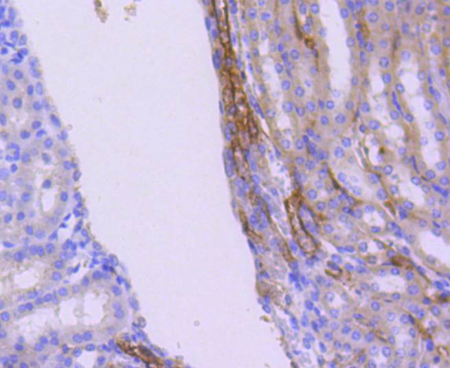 WASF2 Rabbit mAb