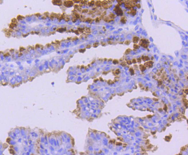 WASF2 Rabbit mAb