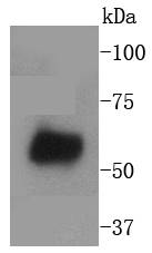 WASF2 Rabbit mAb