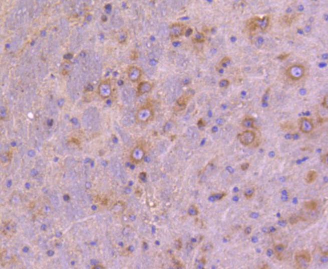 ATG9A Rabbit mAb