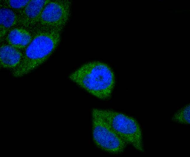 MTCO2 Rabbit mAb