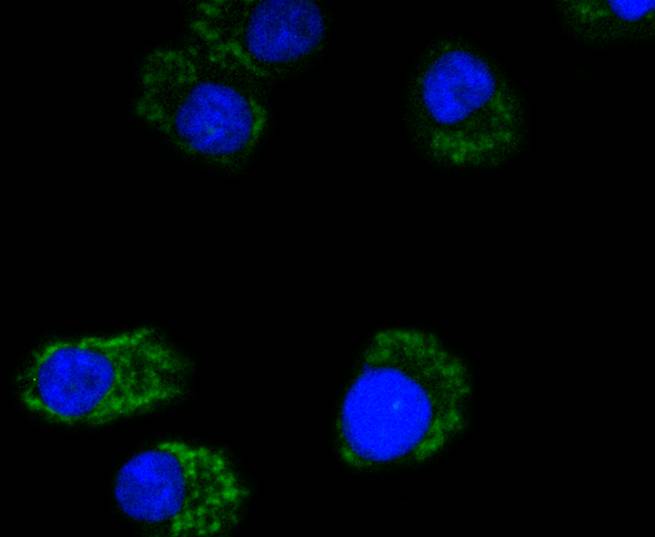 MTCO2 Rabbit mAb