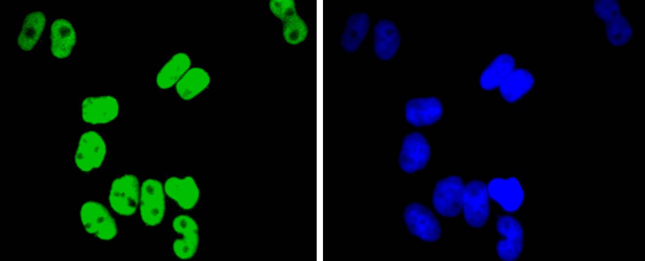 TCF7L2 Rabbit mAb