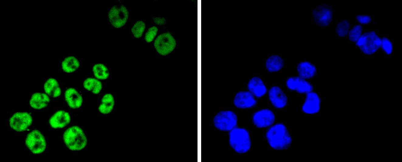 TCF7L2 Rabbit mAb