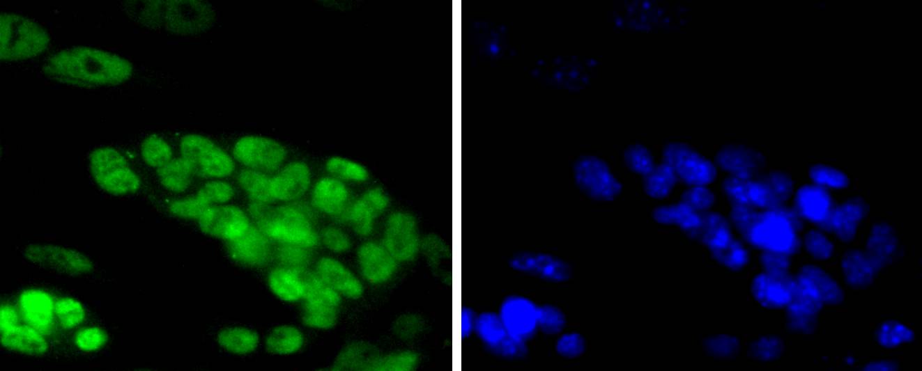 TCF7L2 Rabbit mAb