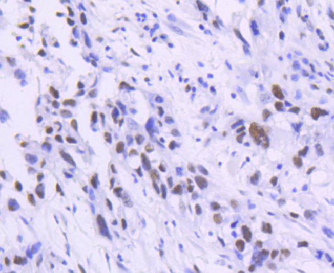 TCF7L2 Rabbit mAb