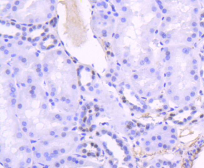 TCF7L2 Rabbit mAb