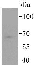 TCF7L2 Rabbit mAb