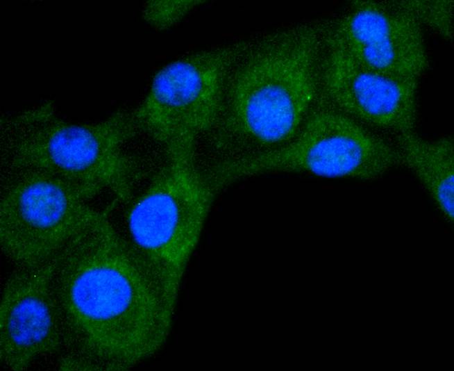 DIABLO Rabbit mAb