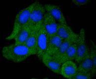 AKAP14 Rabbit mAb