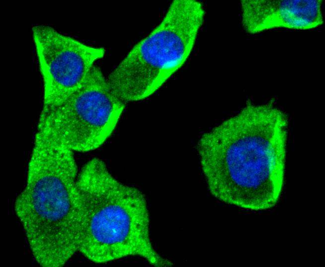 AKAP14 Rabbit mAb