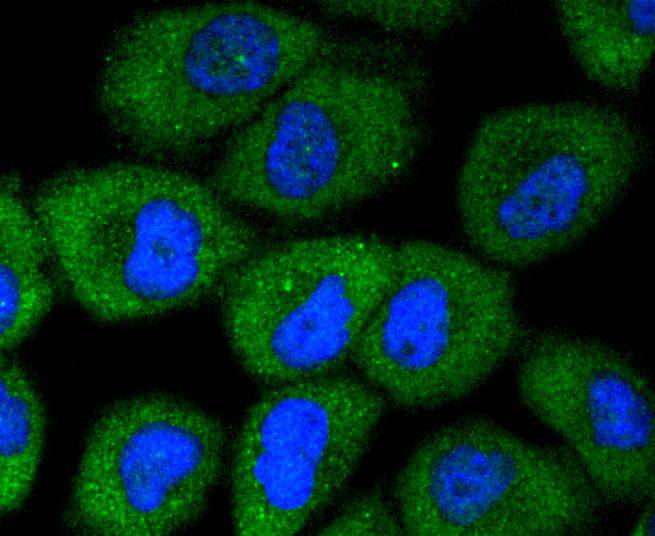 AKAP14 Rabbit mAb