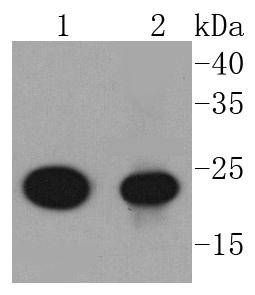 AKAP14 Rabbit mAb