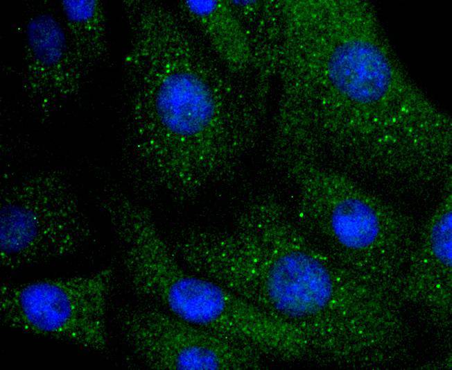 Integrin linked ILK Rabbit mAb