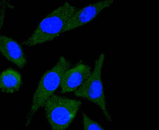 Integrin linked ILK Rabbit mAb