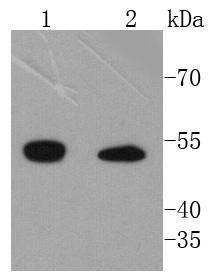 Integrin linked ILK Rabbit mAb