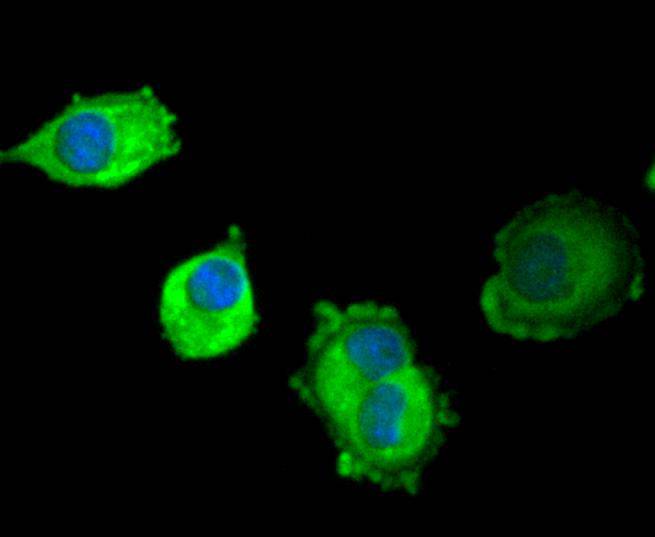 SCF Rabbit mAb