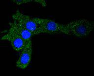 Ferritin Rabbit mAb