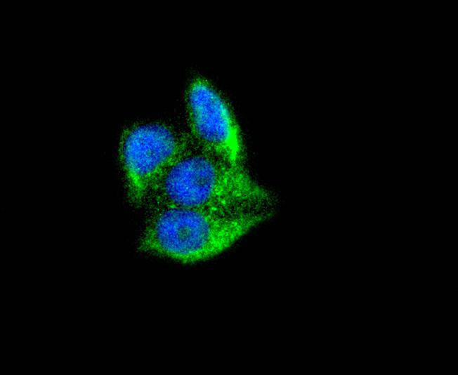 Ferritin Rabbit mAb