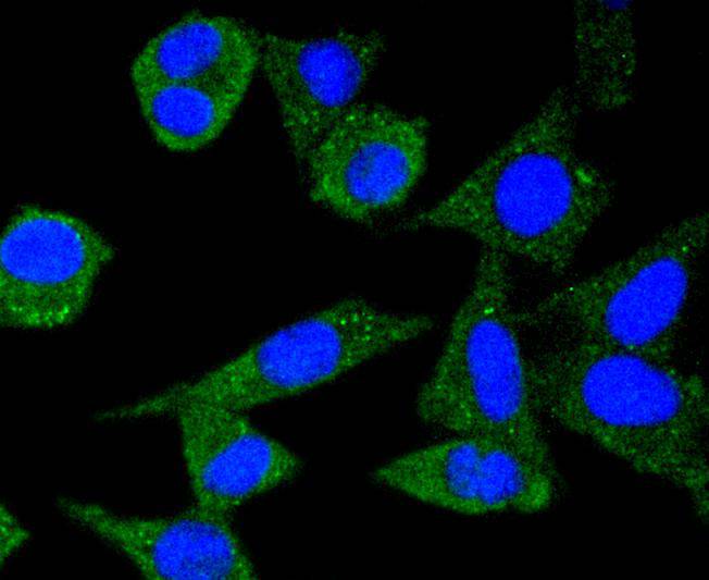 Ferritin Rabbit mAb