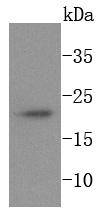 Ferritin Rabbit mAb