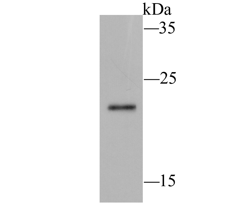 Ferritin Rabbit mAb