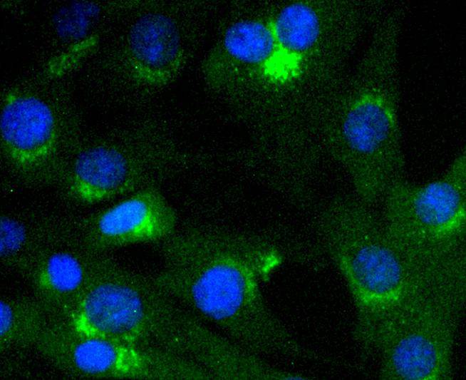 VAV2 Rabbit mAb