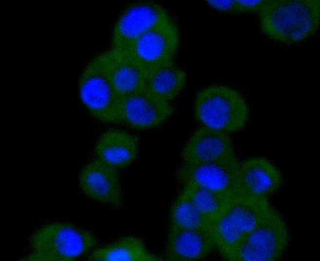 VAV2 Rabbit mAb