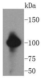 VAV2 Rabbit mAb