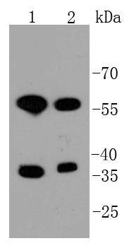 Mst2 Rabbit mAb