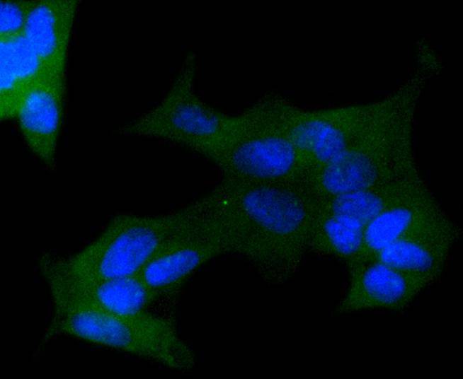 APC Rabbit mAb