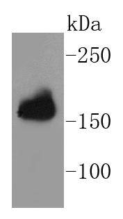 APC Rabbit mAb