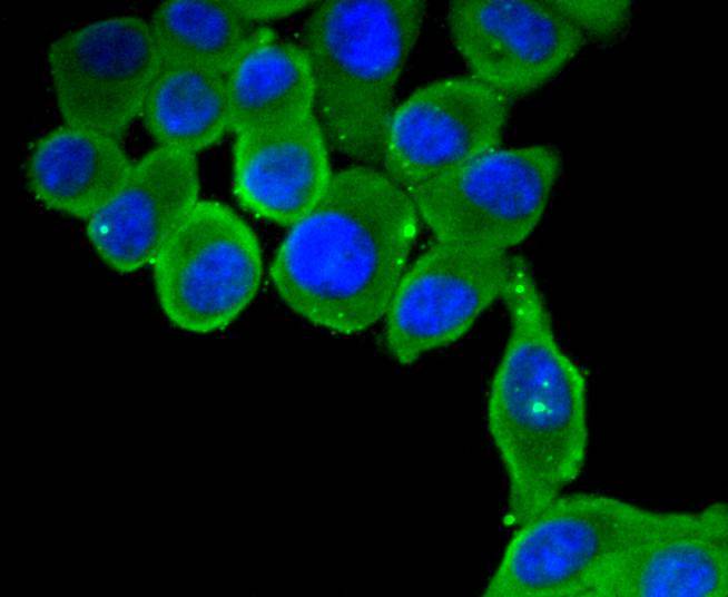 MyD88 Rabbit mAb