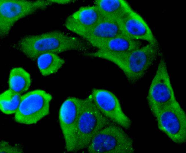 MyD88 Rabbit mAb