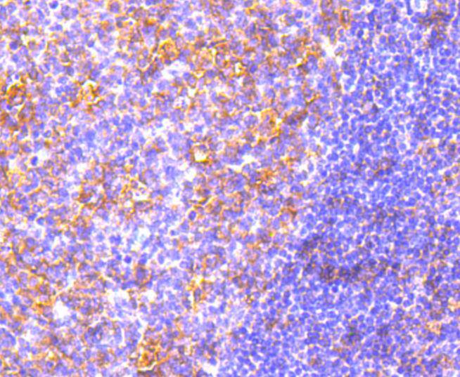 MyD88 Rabbit mAb