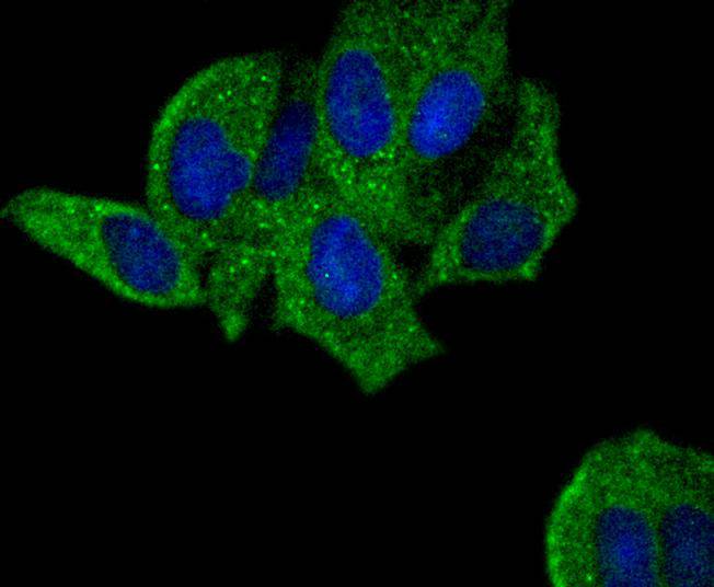 PYK2 Rabbit mAb