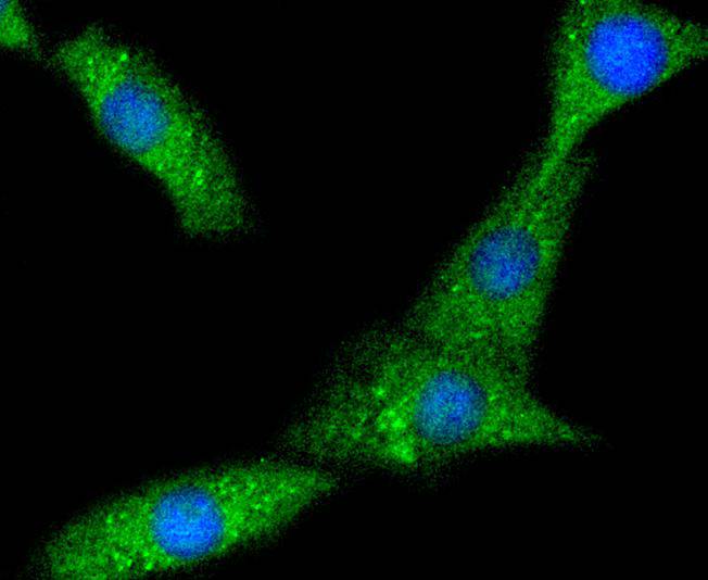 PYK2 Rabbit mAb