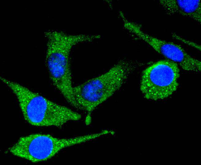 PYK2 Rabbit mAb